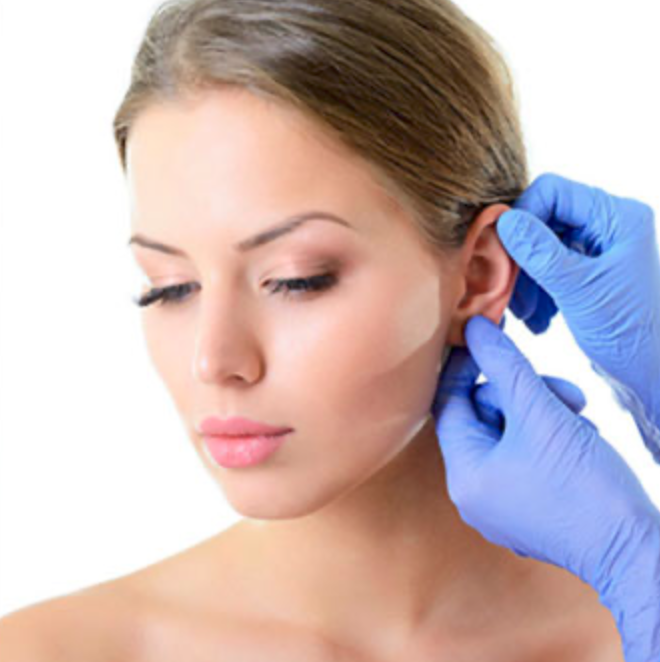 otoplastia-en-cadiz