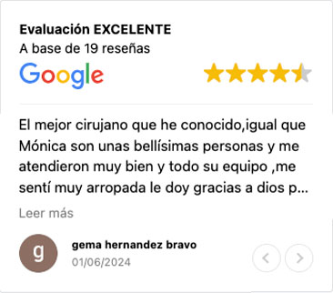 review-nms-03