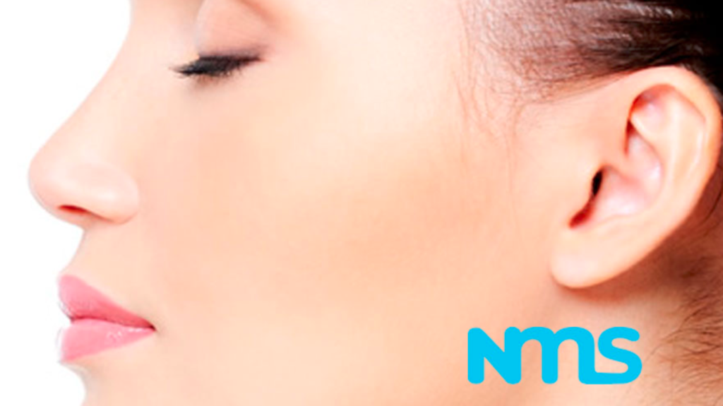 rinoplastia-cadiz